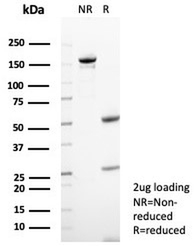 CD23 Antibody