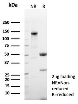 CD23 Antibody
