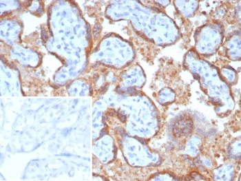 Epstein-Barr virus induced 3 Antibody / EBI3