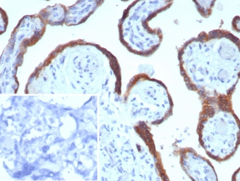 Epstein-Barr virus induced 3 Antibody / EBI3