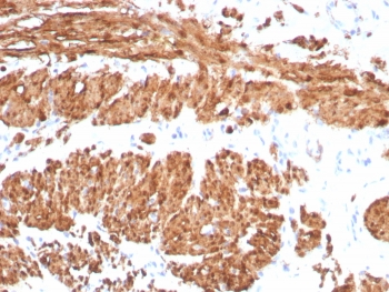 Calponin 1 Antibody / CNN1