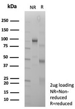 SMARCA4 Antibody / BRG1