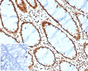 SMARCA4 Antibody / BRG1