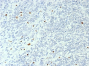 SMARCA4 Antibody / BRG1