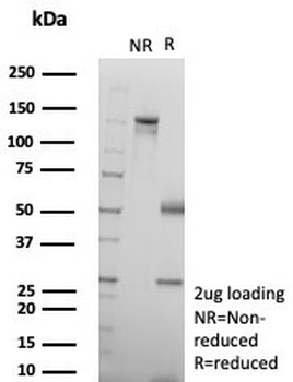 Recombinant SMAD4 Antibody