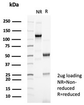 Recombinant CDH2 Antibody / Cadherin-2 / N-Cadherin