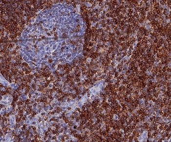 CD7 Antibody