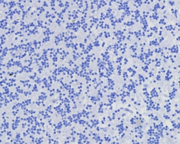 CD7 Antibody