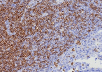 CD7 Antibody