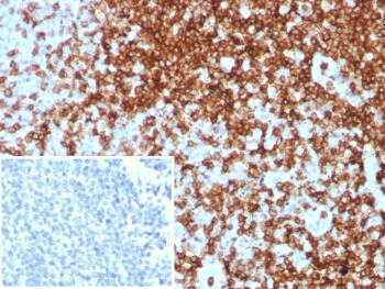 CD7 Antibody