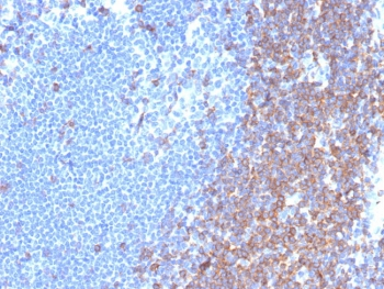 CD7 Antibody