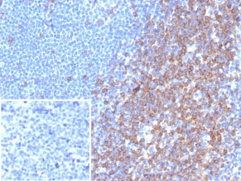CD7 Antibody