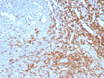 CD7 Antibody