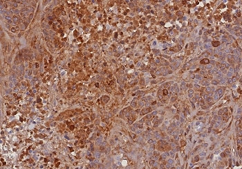 TIMP2 Antibody