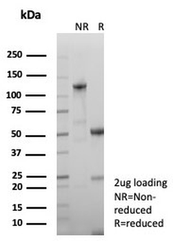 Growth Hormone Antibody / GH1