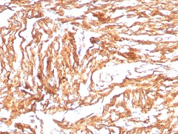 N-Cadherin Antibody / CDH2 / Cadherin 2