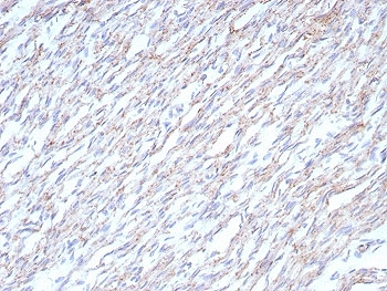 Cadherin 2 Antibody / CDH2 / N-Cadherin