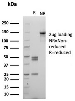 MPO Antibody / Myeloperoxidase