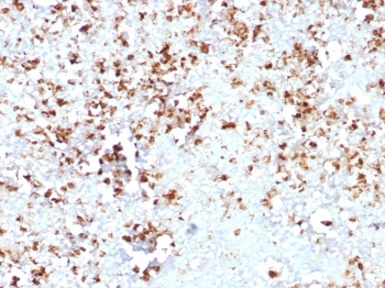 MPO Antibody / Myeloperoxidase