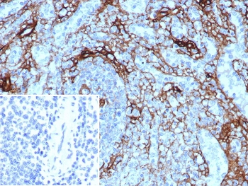CD271 Antibody / NGF Receptor / p75NTR