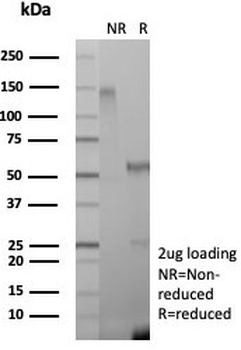 CD271 Antibody / NGF Receptor / p75NTR