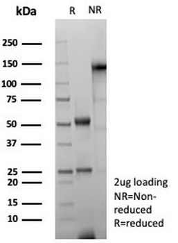Recombinant GFAP Antibody / Glial Fibrillary Acidic Protein