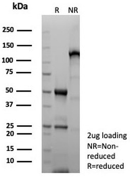 GFAP Antibody / Glial Fibrillary Acidic Protein