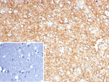 GFAP Antibody / Glial Fibrillary Acidic Protein