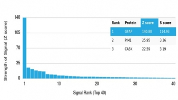 GFAP Antibody / Glial Fibrillary Acidic Protein