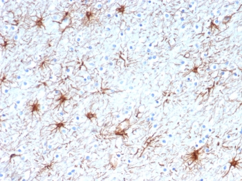 GFAP Antibody / Glial Fibrillary Acidic Protein