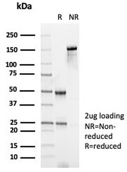 GFAP Antibody / Glial Fibrillary Acidic Protein