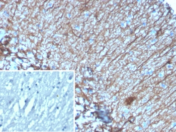 GFAP Antibody / Glial Fibrillary Acidic Protein