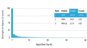 GFAP Antibody / Glial Fibrillary Acidic Protein