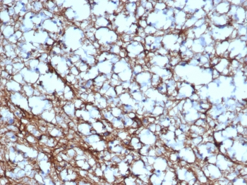 GFAP Antibody / Glial Fibrillary Acidic Protein