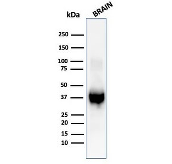 GFAP Antibody / Glial Fibrillary Acidic Protein