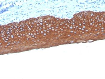 Pan Cytokeratin Antibody Cocktail (Acidic + Basic)