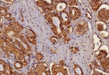 Pan Cytokeratin Antibody Cocktail (Acidic + Basic)