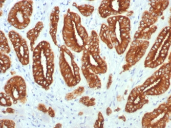 Type I Cytokeratin Antibody / Acidic / LMW