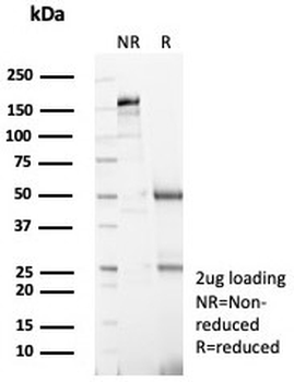 Topoisomerase II alpha Antibody / TOP2A