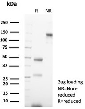 Recombinant Keratin 14 Antibody / Cytokeratin 14 / KRT14