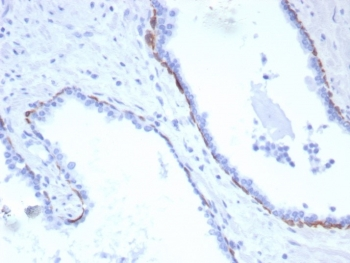 Recombinant Cytokeratin 17 Antibody / KRT17