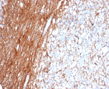 Glial Fibrillary Acidic Protein Antibody / GFAP