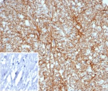 Glial Fibrillary Acidic Protein Antibody / GFAP