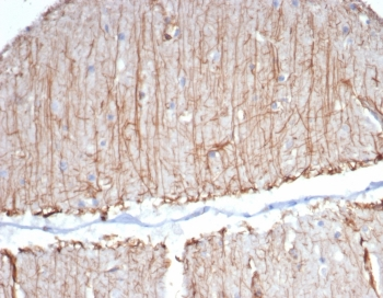 GFAP Antibody / Glial Fibrillary Acidic Protein