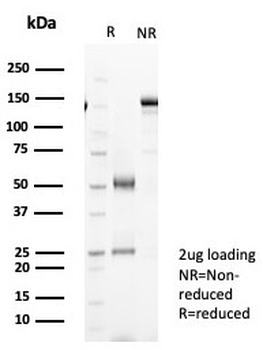 Recombinant CK19 Antibody / Cytokeratin 19
