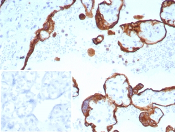Acidic Cytokeratin Antibody / LMW / Type I