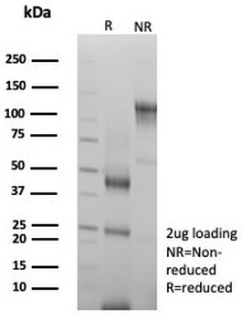 Acidic Cytokeratin Antibody / LMW / Type I