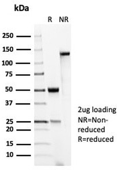 Recombinant p53 Antibody / TP53