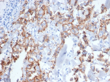 HER2 Antibody / ErbB2 / Extracellular region