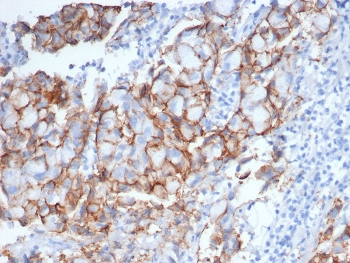 HER2 Antibody / ErbB2 / Extracellular region